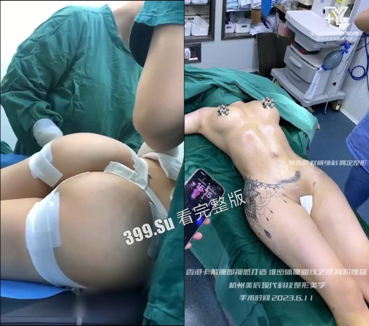 医美整形那些事儿 假的真不了  女人对自己真狠 阴唇黑了就直接切掉 （二）-5