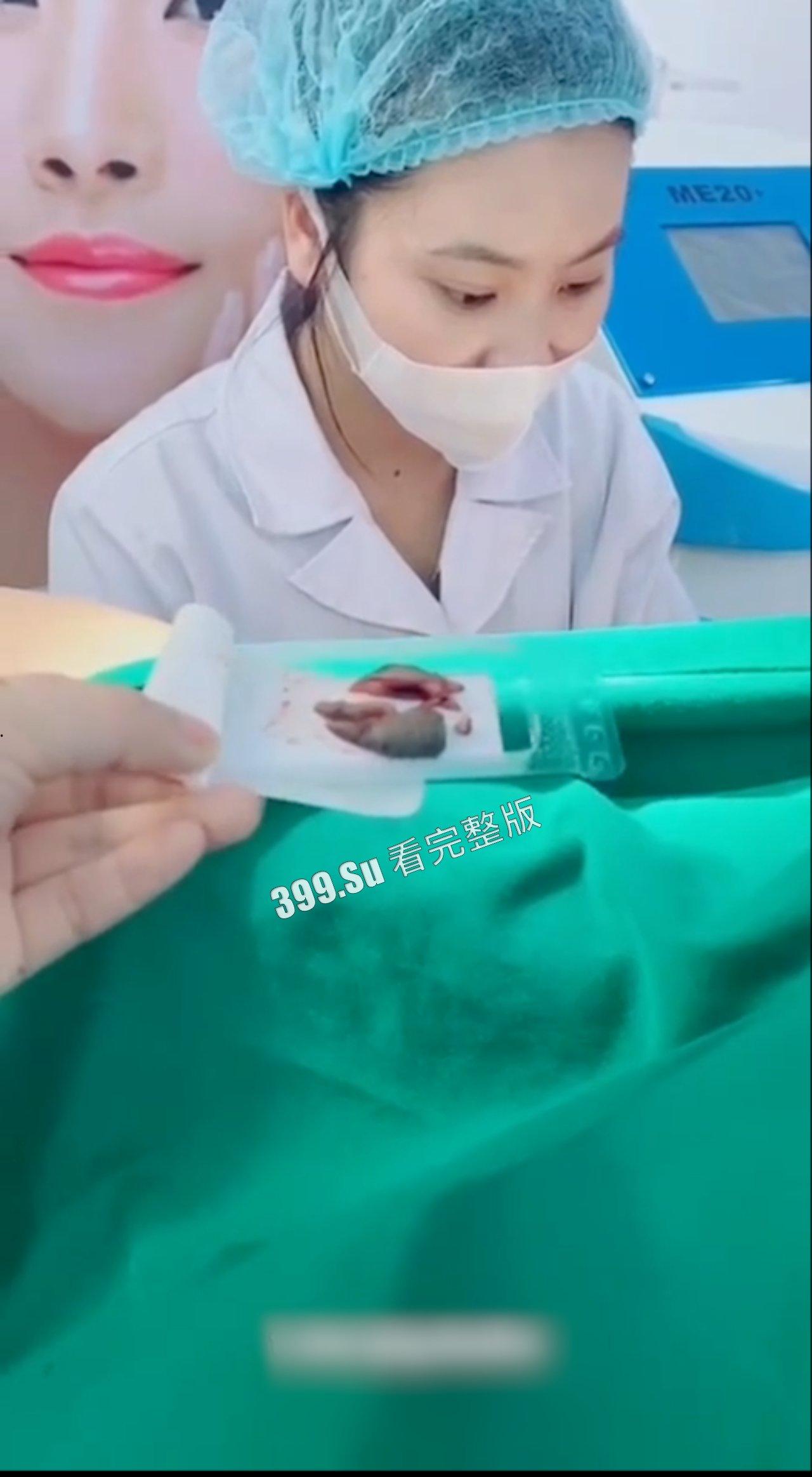 医美整形那些事儿 假的真不了  女人对自己真狠 阴唇黑了就直接切掉 （二）-9