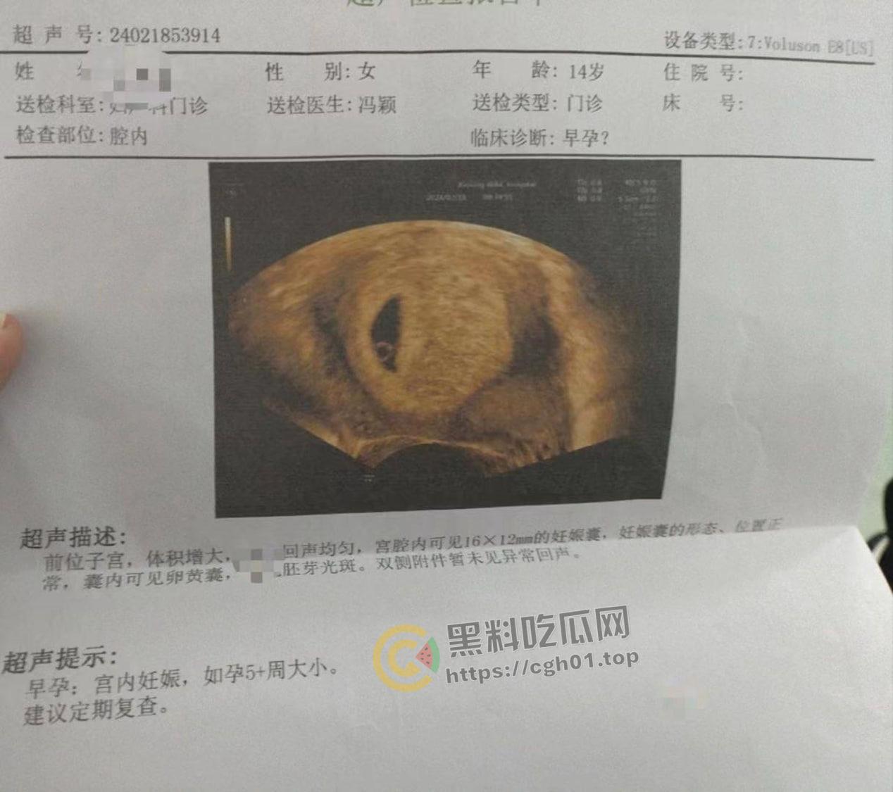 初中生小畜生【黄明昊】把女朋友搞怀孕 逆天发言生出来就踹死-1