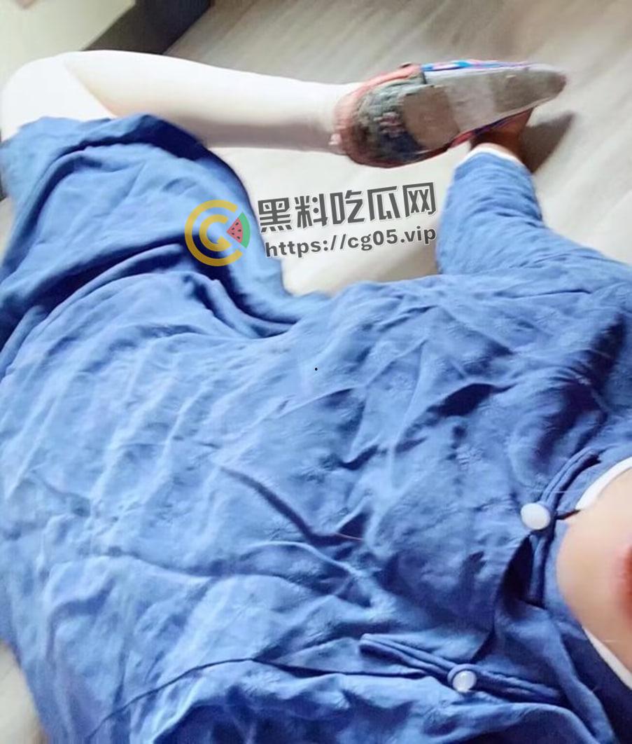 新时代裹脚女性！00后女生爱上裹脚 推特分享裹脚经历 把脚缠到骨折变形 吓人！-16