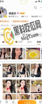 抖音 快手 微博 三栖网红「娜露呀」真正土豪福利流出 微密圈弱爆了！-1